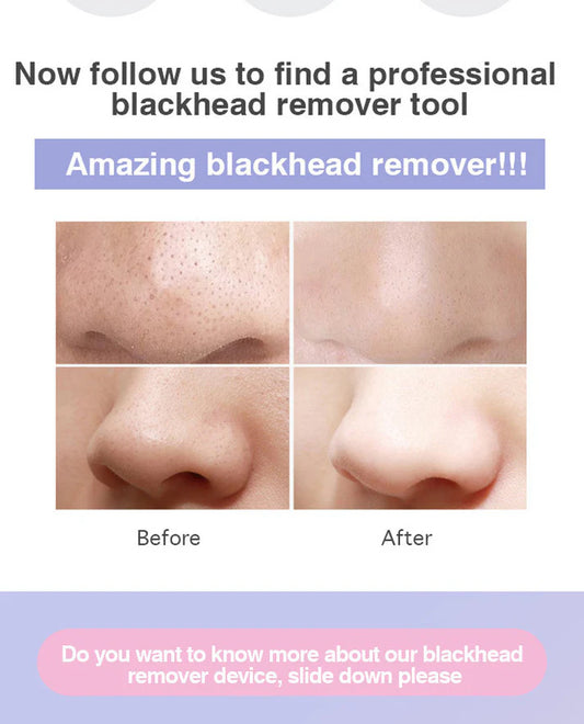 Electric Pore Blackhead Remover