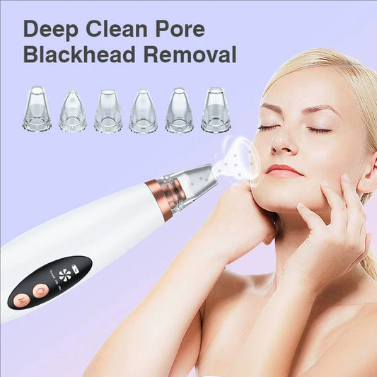 Electric Pore Blackhead Remover
