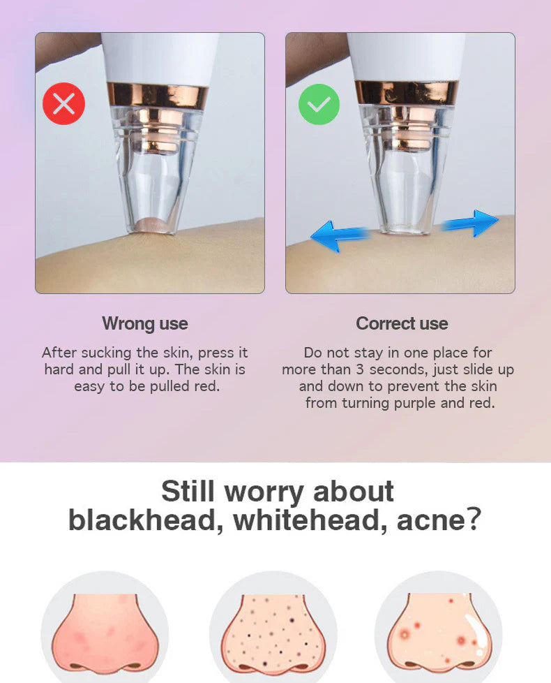 Electric Pore Blackhead Remover