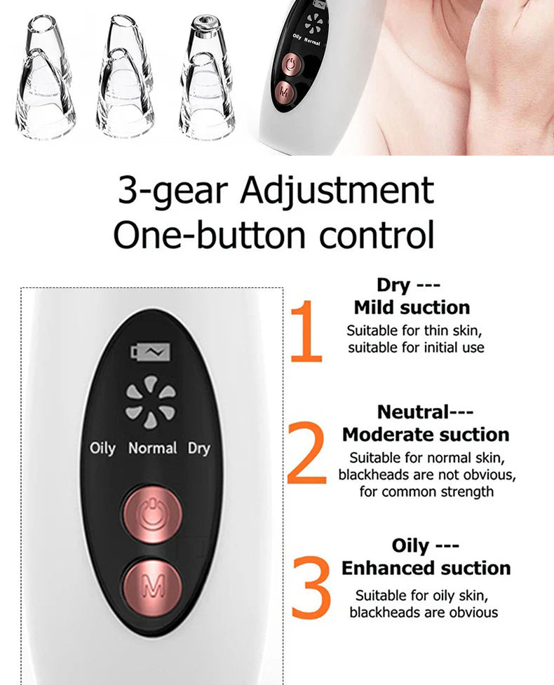 Electric Pore Blackhead Remover